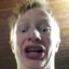 Downs syndrom_Ginger