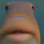 SMEGMA