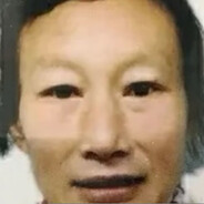 我有唐氏综合征