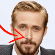 у меня эпилепсия