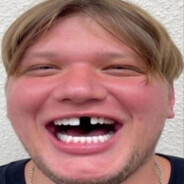 absolute(:)Awp_Giga_Chad(/)