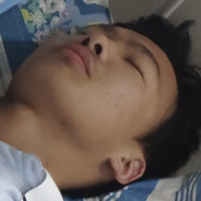 李富国（已切除甲状腺