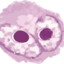 Reed-Sternberg Cell