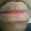 Dry ass lip havin ass