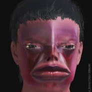 WL