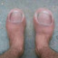 cursed toe toe