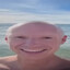 baldmonke