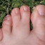 Double Toe