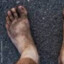 Homeless feet