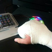 я сломал правую р