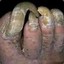 SuckMyToes