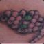 Tonus