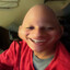 el huevo-- CSGOSKINS