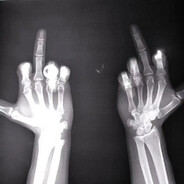 她说她是晒黑的