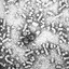 Hepatitis B
