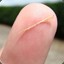 A Small Intrusive Finger