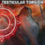 Testicular Torsion Wizard