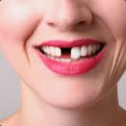 ᵇʳᵒ👌👌👌👌