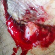 西门庆击杀了武大郎