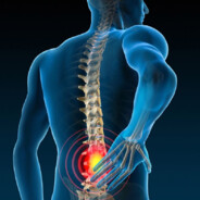 Chronic Back Pain