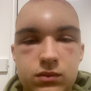 ТУРБОНАДУВ(BLOODLUST)