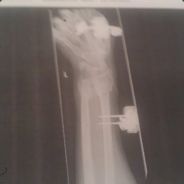 jakal - steam id 76561197960423551