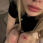 глотаю яйца