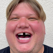 S1mple Bonk's avatar