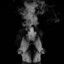 iSmoke