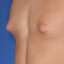Gyno