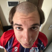 Papita_equisde