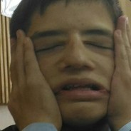 BOBA ПИЗДАБОЛ