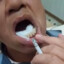 Dr.Tekson