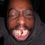Local Crackhead