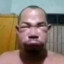 Allan apenas