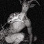 Goatman