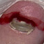 Bloody Toe