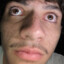 willybumm