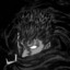 Guts