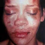Breezy Beats His Shorty