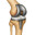 Knee Replacement