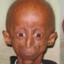 simios y argentos  dan progeria