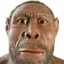 hydrensis