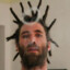 xLombrado