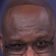 shaqs droopy forehead