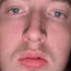 turbo runk