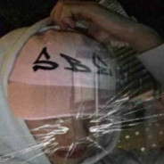 BlackKraySmertelnejDawceKetaminy