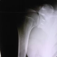yippie' - steam id 76561197961391309