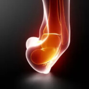 twisted ankle - steam id 76561199507039281