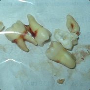 ][cinch][ - steam id 76561197961450476